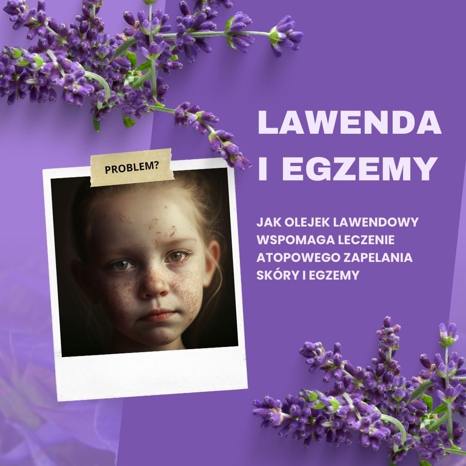 olejek lawendowy w leczeniu egzemy i atopowego zapalenia skory
